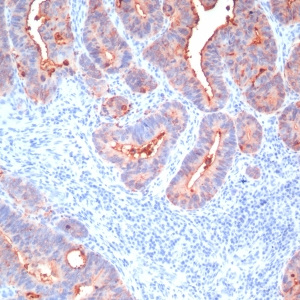 Carcinoembryonic Antigen, pan (CEA) / CD66; Clone Cocktail (Concentrate)